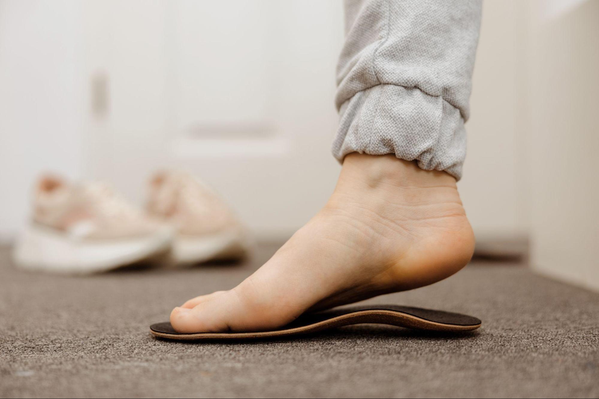 why is high arch foot treatment necessary